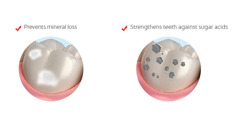 helps prevent tooth decay and caries