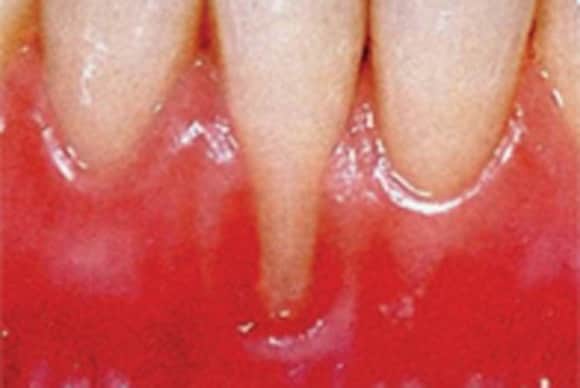 profed localized recession